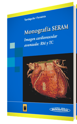 MONOGRAFIA SERAM