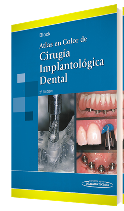 ATLAS EN COLOR DE CIRUGIA IMPLANTOLOGICA DENTAL