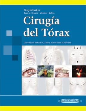 CIRUGIA DEL TORAX