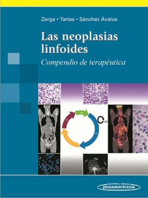 las neoplasias linfoides