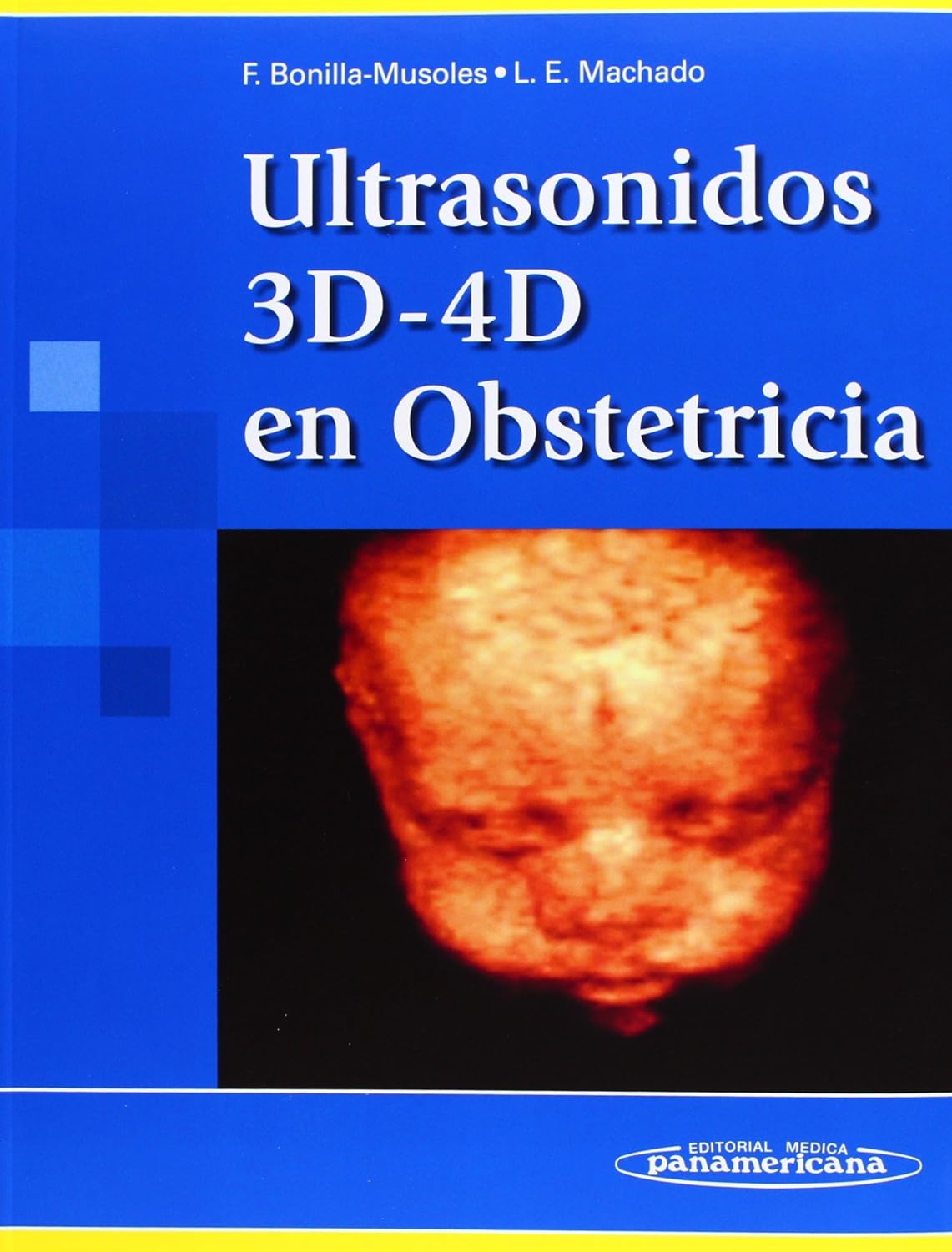 ULTRASONIDOS 3D-4D EN OBSTETRICIA